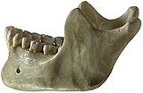 180px-Human_jawbone_left